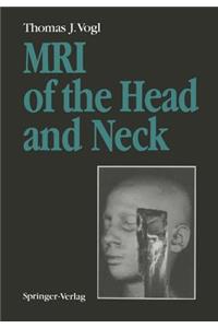 MRI of the Head and Neck