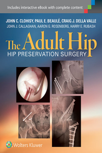 Adult Hip: Hip Preservation Surgery