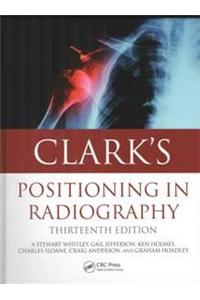Clark’s Positioning in Radiography