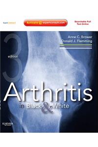Arthritis in Black & White