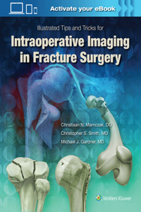 Illustrated Tips and Tricks for Intraoperative Imaging in Fracture Surgery