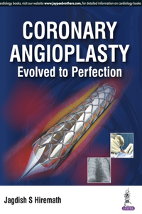 Coronary Angioplasty