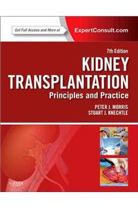 Kidney Transplantation with Access Code: Principles and Practice