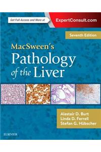 Macsween's Pathology of the Liver