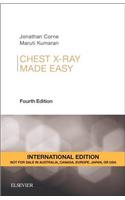 Chest X-Ray Made Easy