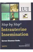 Step by Step Intrauterine Insemination (with DVD-ROM)