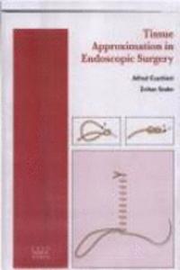 Laparoscopic Inguinal Hernia Repair