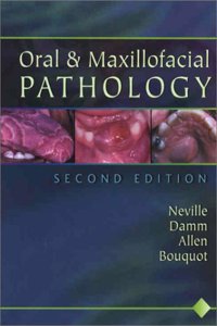 Oral and Maxillofacial Pathology