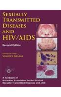 HIV/AIDS