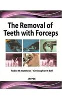 The Removal of Teeth with Forceps