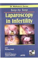 Step by Step Laparoscopy in Infertility