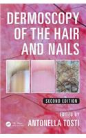 Dermoscopy of the Hair and Nails