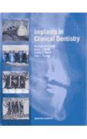 Implants in Clinical Dentistry