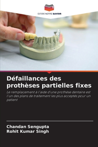 Défaillances des prothèses partielles fixes