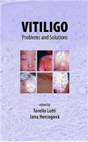 Vitiligo