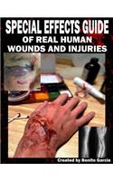 Special Effects Guide Of Real Human Wounds and Injuries