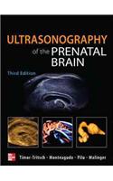 Ultrasonography of the Prenatal Brain