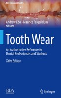 Tooth Wear: An Authoritative Reference for Dental Professionals and Students (BDJ Clinician's Guides)