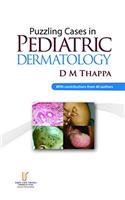 Puzzling Cases in Pediatric Dermatology