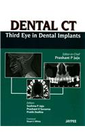 Dental CT Third Eye in Dental Implants