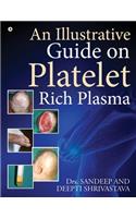 Illustrative Guide on Platelet Rich Plasma