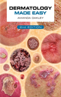 Dermatology Made Easy, Second Edition