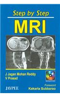 Step by Step MRI with CD-ROM