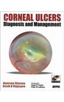 Corneal Ulcers Diagnosis and Management