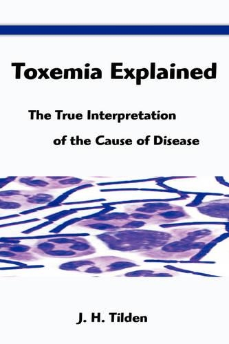 Toxemia Explained
