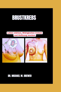 Brustkrebs