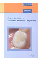 Successful Posterior Composites