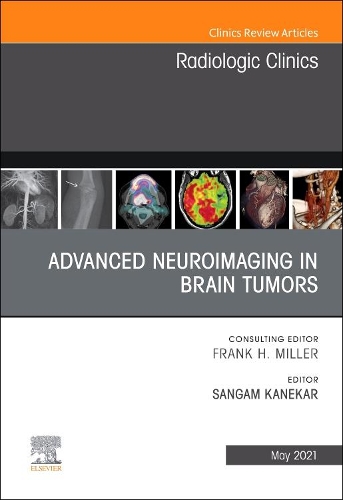 Advanced Neuroimaging in Brain Tumors, an Issue of Radiologic Clinics of North America