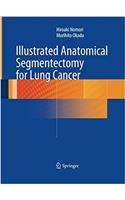 Illustrated Anatomical Segmentectomy for Lung Cancer