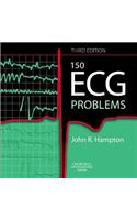 150 ECG Problems, International Edition