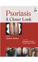 Psoriasis