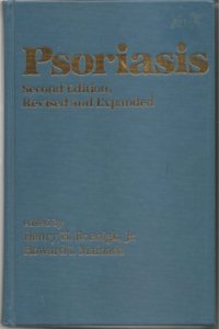Psoriasis