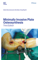 Minimally Invasive Plate Osteosynthesis