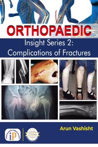 Orthopaedic Insight Series 2: Complications of Fractures
