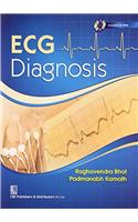 ECG Diagnosis