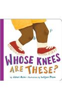 Whose Knees Are These? (New Edition)