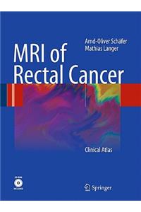 MRI of Rectal Cancer
