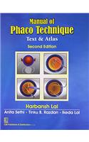 Manual of Phaco Technique