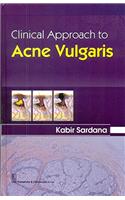 Clinical Approach to Acne Vulgaris