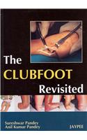 Club Foot Revisited