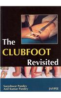 The Club Foot Revisited