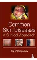 Common Skin Diseases