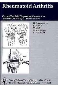 Rheumatoid Arthritis