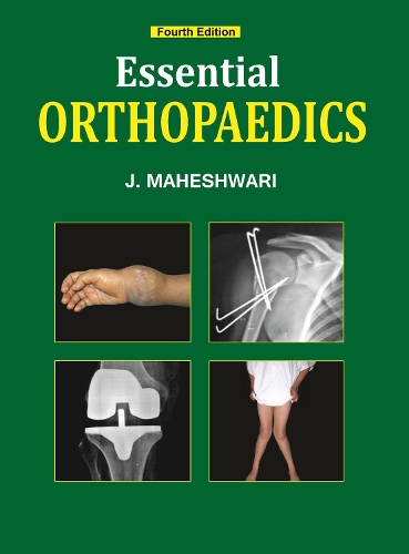 Essential Orthopaedics