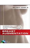 Breast Augmentation [With DVD]