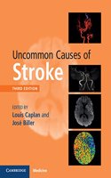 Uncommon Causes of Stroke